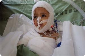Filistinli Çocuğun Yürek Burkan Sorusu:''Beni Neden Yaktılar?''
