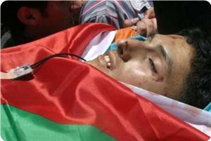 Gazze'de Cuma Günü Gerçekleştirilen Gösteride Yaralanan Bir Filistinli Şehid Oldu