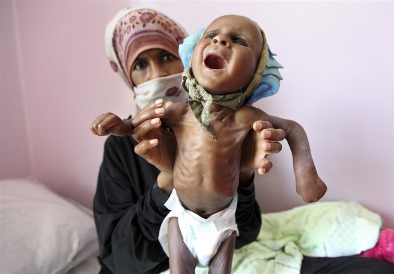 Her 10 Dakikada 1 Yemenli Çocuk Ölüyor