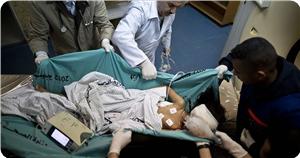 Siyonist Rejim'in Gazze'ye Saldırısında Ağır Yaralanan Çocuk Şehid Oldu